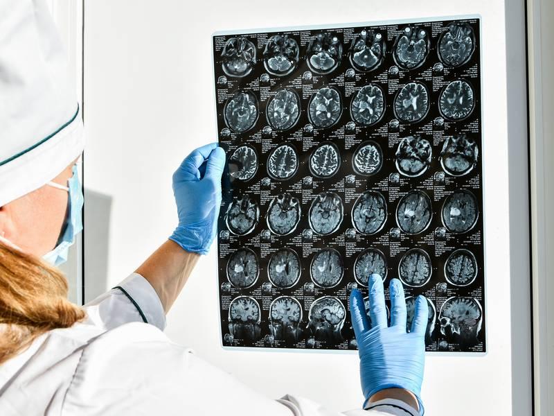MRI Brain Scan in Troy, MI