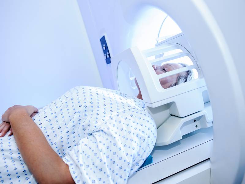 How Do You Prepare For an MRI Brain Scan?