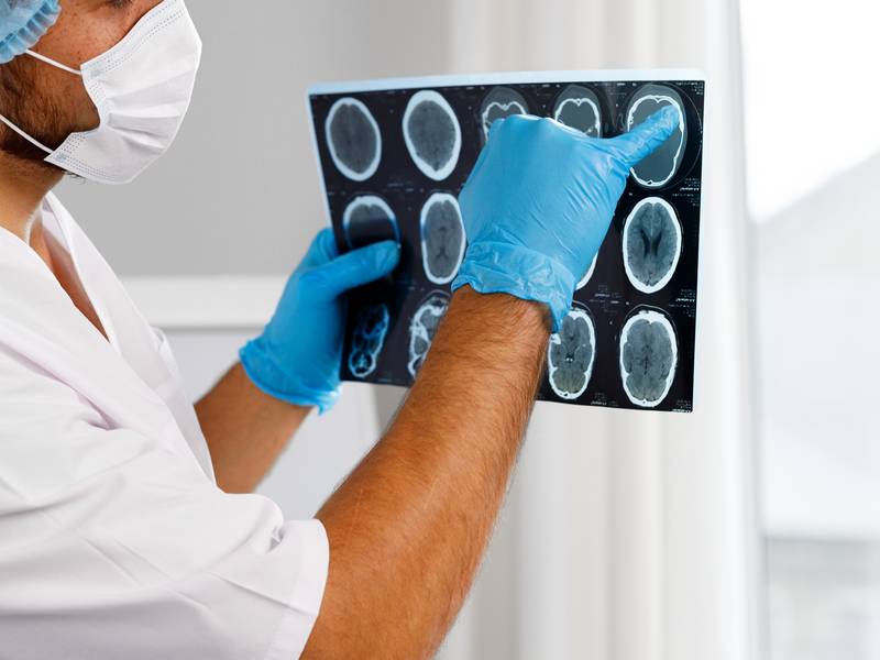 What Problems Can an MRI Test Detect?