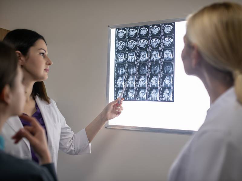 What is an MRI Scan Used to Diagnose? - Michigan Diagnostics