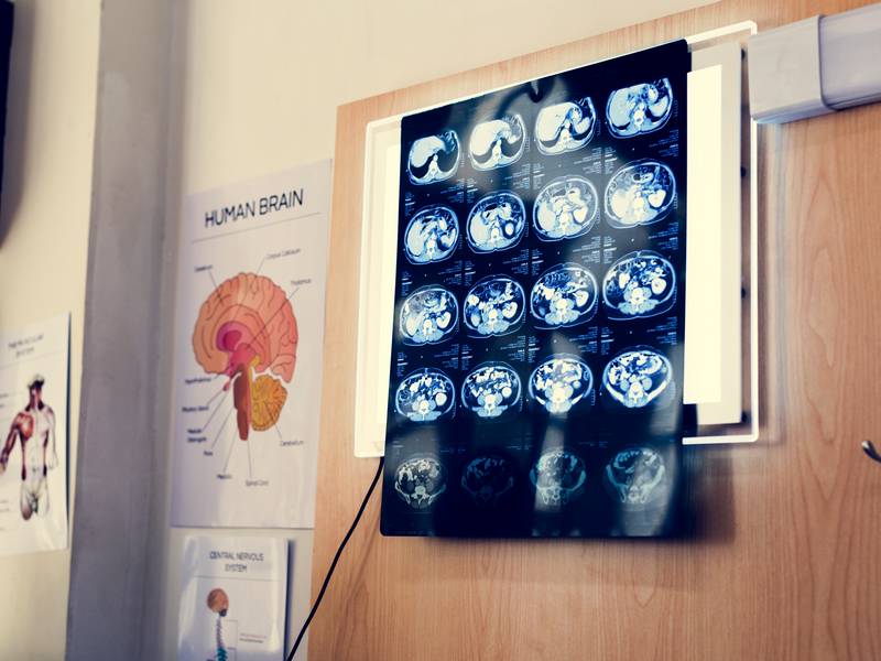 Is MRI Imaging Effective?