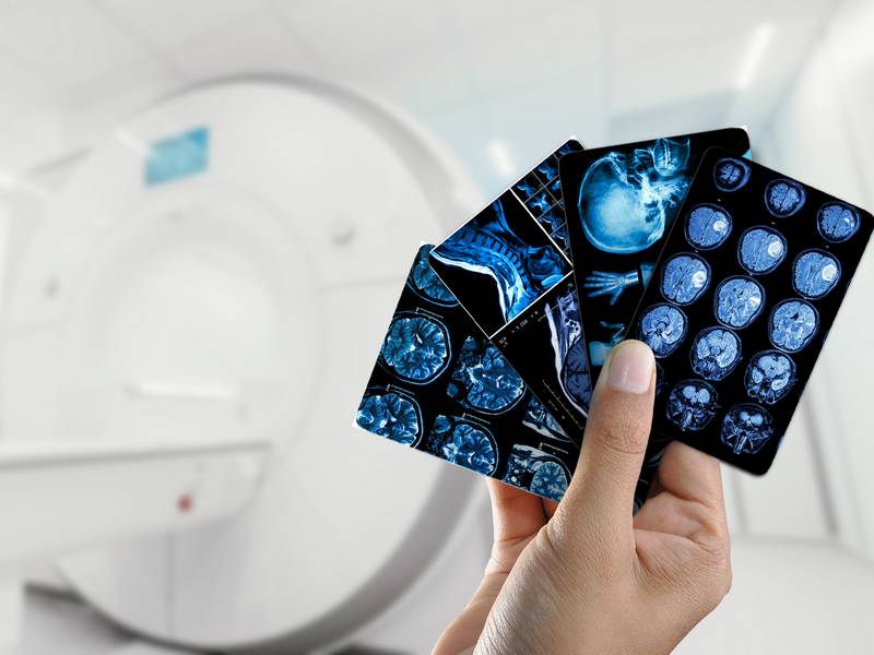 What Should I Expect During an MRI Brain Scan?