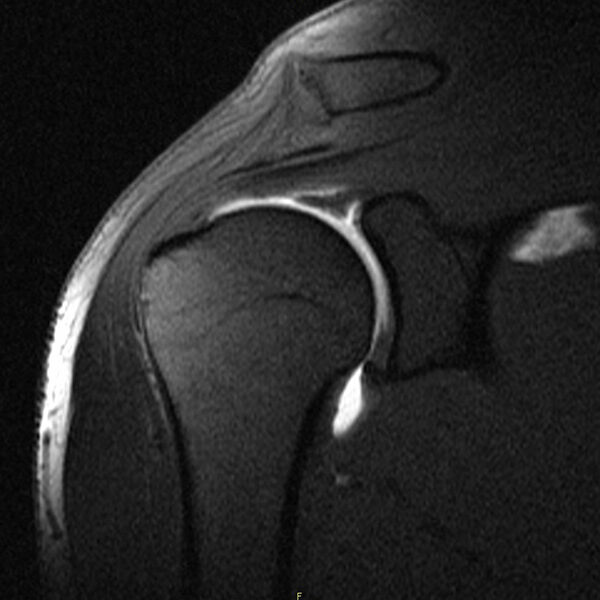 Arthrograms - MRI for Joint Analysis - Michigan Diagnostics